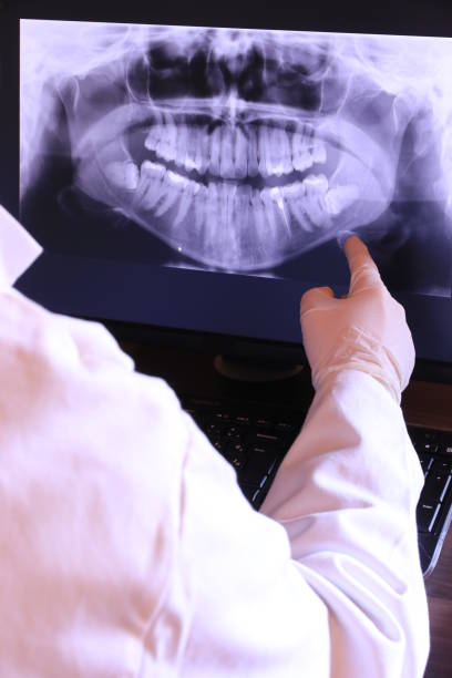 Best Knocked-Out Tooth Emergency  in Clifton Springs, NY