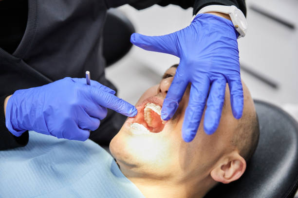 Best Urgent Tooth Repair  in Clifton Springs, NY